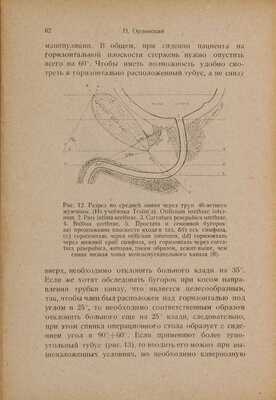 Орловский П. Половая слабость мужчины / P. Orlowsky; пер. с 3-го нем. изд. д-ра И.М. Эпштейна под ред. проф. Р. М. Фронштейна. М.: Изд-во Наркомздрава РСФСР, 1928